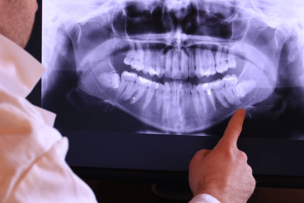 Best Emergency Denture Repair in Weatherford, TX